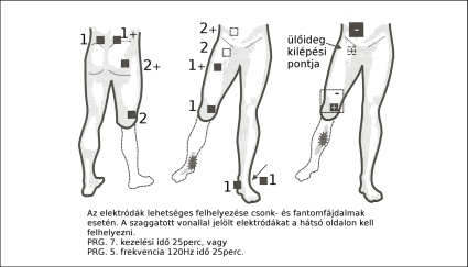 Elektróda felhelyezés
