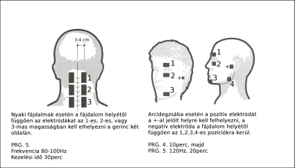 Elektróda felhelyezés