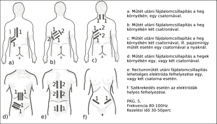 Elektróda felhelyezés